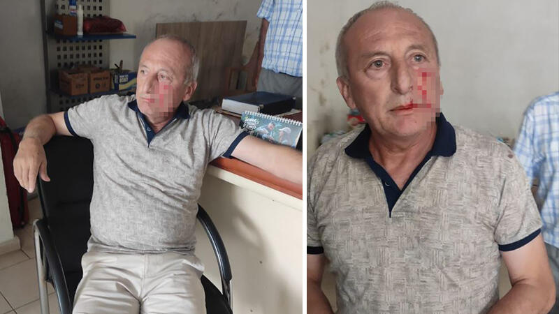 CHP’li Belediye Başkanı Kaynar saldırıya uğramıştı: Nedeni belli oldu